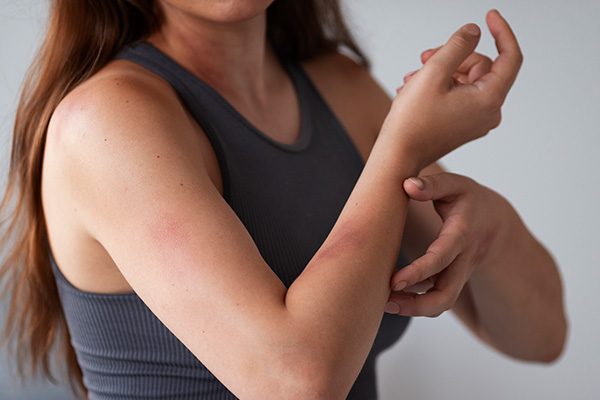 Leia mais sobre o artigo Por que pessoas com Lupus sofrem com dores frequentes?